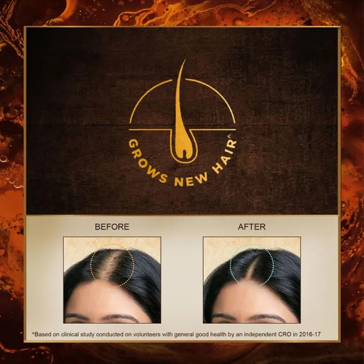 Indulekha%20Bringha%20Hair%20Oil%20(100ml)%20-%20Image%203