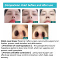 1pc Rhinoplasty Nostril Support Postoperative Silicone Shaping Mold Crooked Nose Correction Fixator Nasal Wing Beauty Noseclip. 