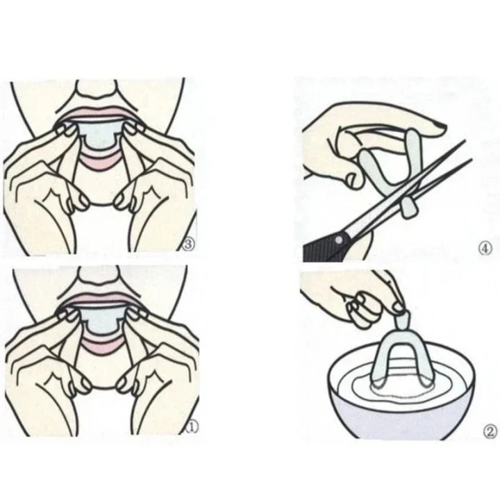 1/2/4/8Pcs%20Anti%20Snoring%20Bruxism%20Sleeping%20Mouth%20Guard%20Night%20Guard%20Gum%20Shield%20Mouth%20Tray%20Stop%20Teeth%20Grinding%20Sleep%20Aid%20Health%20Care%20-%20Image%204
