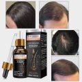 Original Hair Oil ဆံပင်ထိပ်ပြောင်ခြင်း ၊ ဆံပင်ပါးခြင်း ၊ ဆံပင်ကျွတ်ခြင်းတို့ကို အထိရောက်ဆုံးနဲ့ အမြန်ဆုံး ကူညီဖြေရှင်းပေးနိုင်ပါတယ် 

 Original Hair Growth Essential Oil 

 ကျား /  မ မရွေး အသုံးပြုလို့ရပါတယ်ရှင့်

  အရင်းကကျွတ်သွားတဲ့ ဆံပင်အမြစ်တွေကို ပြ. 