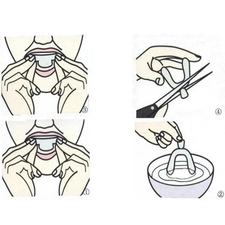 Professional%20Teeth%20%20Tray%20Tooth%20Protector%20Gum%20Dental%20Products%20Teeth%20Straightener%20Teeth%20%20Kit%20Dental%20Dente%20Tools%20-%20Image%206