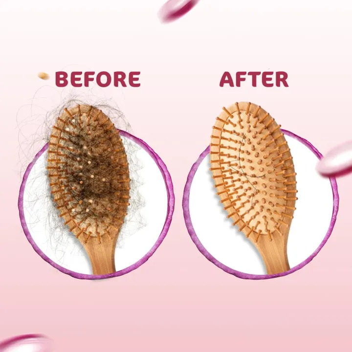 Mamaearth%20Onion%20Shampoo%20for%20Hair%20Growth%20&%20Hair%20Fall%20Control,%20with%20Onion%20Oil%20&%20Plant%20Keratin%20250ml%20-%20Image%205