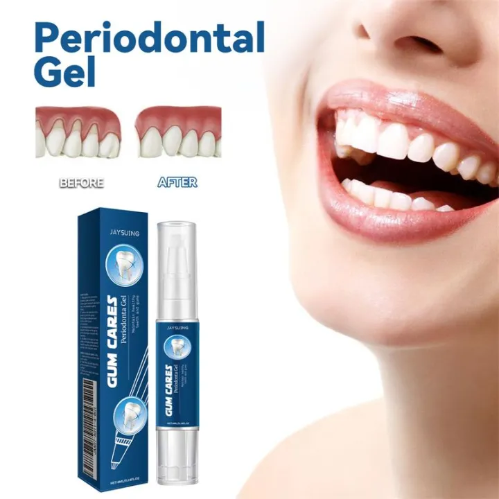 Damaged%20Gum%20Repair%20Care%20Gel%20Relieve%20Sore%20Gums%20Allergy%20Deep%20Cleaning%20Teeth%20Stains%20Tartar%20Serum%20Dental%20Caries%20Toothpaste%20-%20Image%202