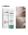 Authentic LANBENA Acne Treatment Gel -20g. 