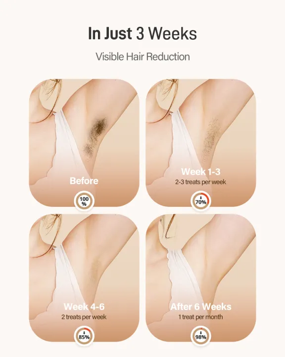 Laser%20Hair%20Removal%20IPL%20Device%20999900%20Flashes%20Dual%20Flashes%20Mode%203%20Weeks%20Visible%20for%20Women%20Men%20Home%20Laser%20Quick%20Safe%20Treament%20-%20Image%204