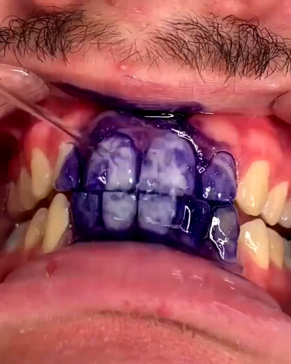 Hismile v34 Purple Teeth Whitening Toothpaste