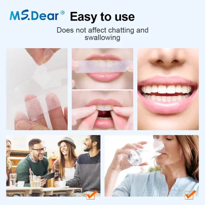 7/14/21/28/70%20Pairs%209D%20Gel%20Teeth%20%20Strip%20White%20Tooth%20Dental%20Kit%20Oral%20Hygiene%20Care%20Strip%20False%20Teeth%20Veneers%20Whiten%20Gel%20-%20Image%203