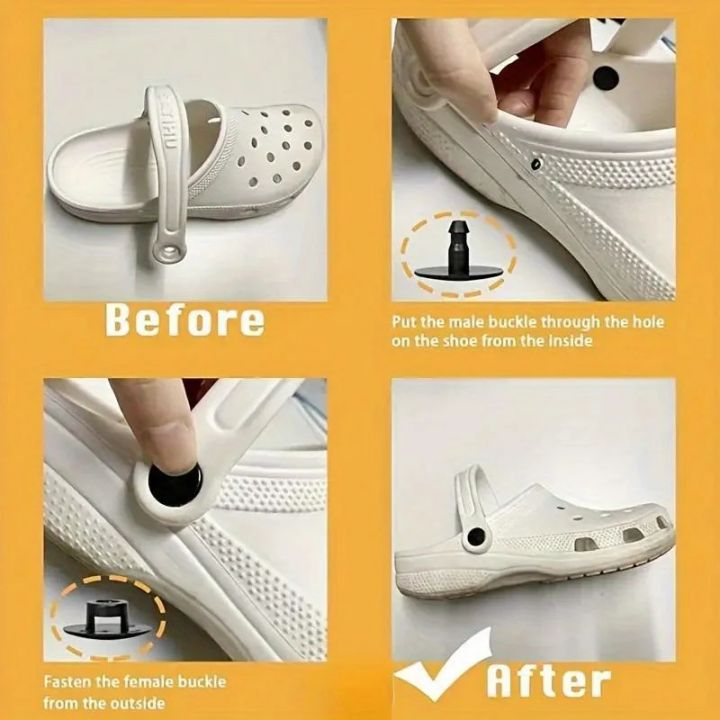 100pcs%20Plastic%20Shoe%20Rivets%20-%20Quick%20Repair%20Accessory%20for%20Foam%20Clogs%20and%20Slip-On%20Footwear%20-%20Durable%20Snap%20Fastener%20Buttons%20-%20Black%20-%20Image%205
