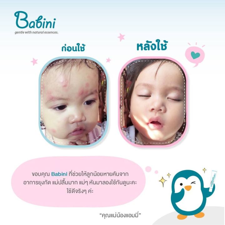 Provamed%20Babini%20Soothing%20Cream%20%5BProduct%20Available%20in%202%20Sizes%5D%20Skin%20Cream%20for%20Children,%20Rashes,%20and%20Hives.%20-%20Image%205