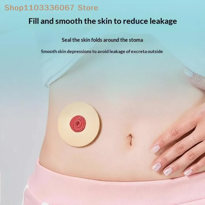 %E3%80%90HL%E3%80%9110Pcs%20Anti-Leakage%20Leak-proof%20Ring%20For%20Colostomy%20Bag%20Ostomy%20Paste%20Ring%20Baseplates%20Stoma%20Care%20Products%20To%20Protect%20Skin%202/4mm%20-%20Image%205