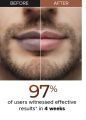 Lip Balm for Smokers , Ultra Hydrating & Nourishing Lip Balm , Lip Lightener Balm Dry & Dark Lips , Smokers Lip Balm Lips Relieves dry -10g. 