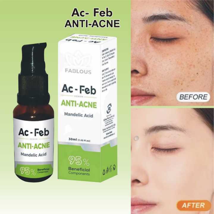 Ac%20Feb%20Anti-Acne%20Serum%20%E2%80%93%2030ml%20-%20Image%203