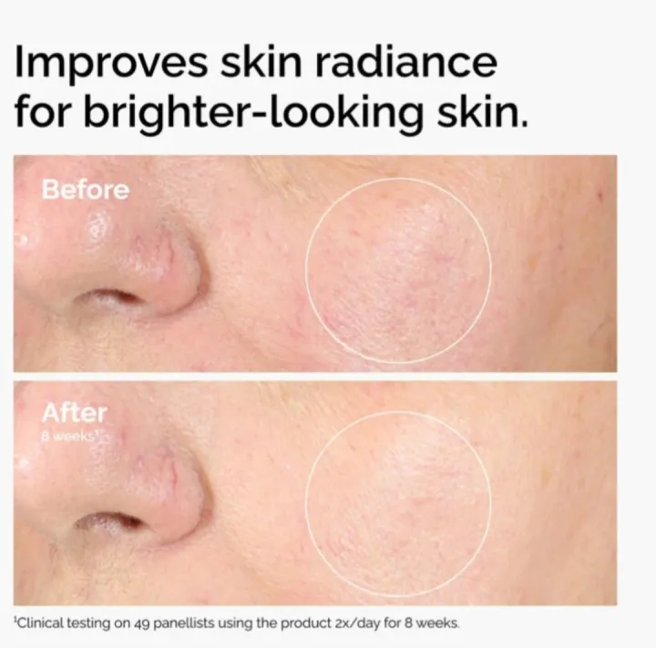 Alpha%20Arbutin%202%25%20+%20HA%20-%2030%20ml%20(Double%20Layer%20Labelling)%20-%20Image%207