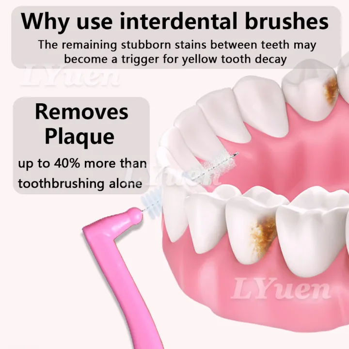 20Pcs/box%20L%20Shape%20Push-Pull%20Interdental%20Brush%20Orthodontic%20Toothpick%20Teeth%20%20Tooth%20Pick%20ToothBrush%20Oral%20Hygiene%20Care%20-%20Image%202