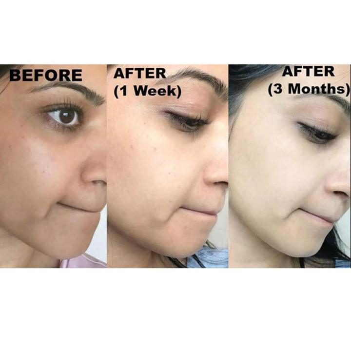 Kojie%20San%20Skin%20Lightening%20Soap%20%E2%80%93%2065g%20x%203%20Pieces%20%7C%20Brightening%20&%20Whitening%20Formula%20For%20Even%20Skin%20Tone%20-%20Image%204
