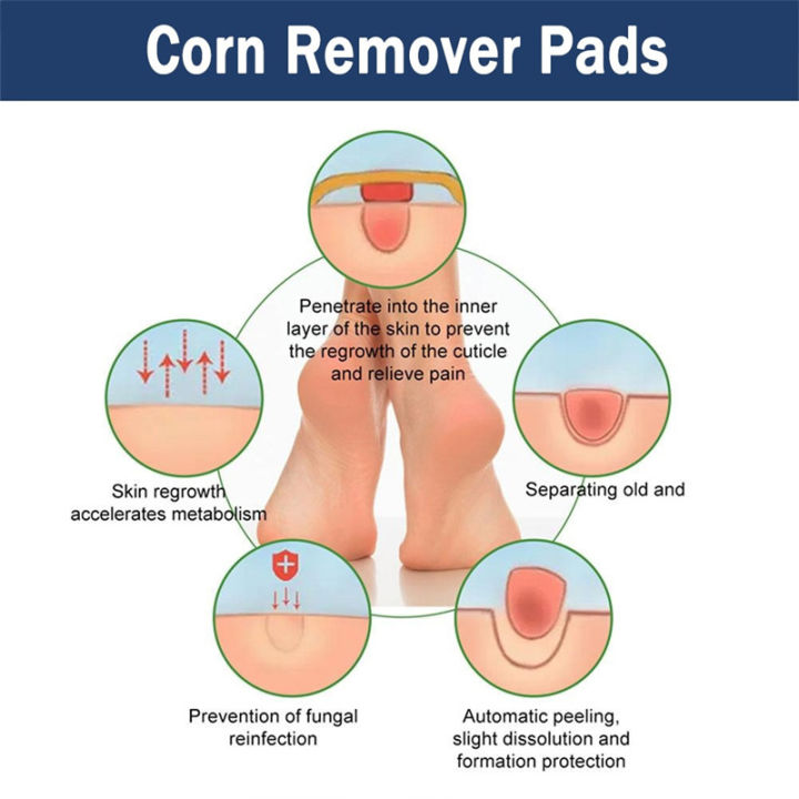 Dr.Jemeesen%20Corn%20Remover%20Pads%20for%20Feet%20Toes:%2030%20Pack%20Salicylic%20Acid%20Extra%20Strength%20Treatment%20-%20Fast%20Effective%20Medicated%20Bandages%20-%20Image%205