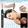 VITCOCO Otoscope Ear Wax Removal 
Visual Digging Ear Spoon 3.0mm Ultra-Thin 
Otoscope Wifi HD Wireless Ear picking 
Mirror Endoscop. 