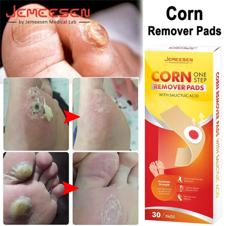 Dr.Jemeesen%20Corn%20Remover%20Pads%20for%20Feet%20Toes:%2030%20Pack%20Salicylic%20Acid%20Extra%20Strength%20Treatment%20-%20Fast%20Effective%20Medicated%20Bandages%20-%20Image%203