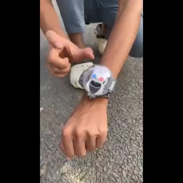 World’s Smallest RC Car – Metal Body Mini Remote Control Car with Watch Controller | Rechargeable Micro RC Car Toy for Boys