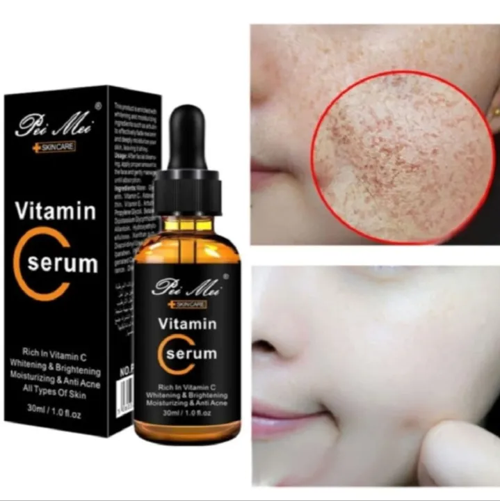Pei%20Mei%20Vitamin%20C%20Moisturizing%20&%20Anti-Acne%20Face%20Serum%20-%2030ml%20-%20Image%202