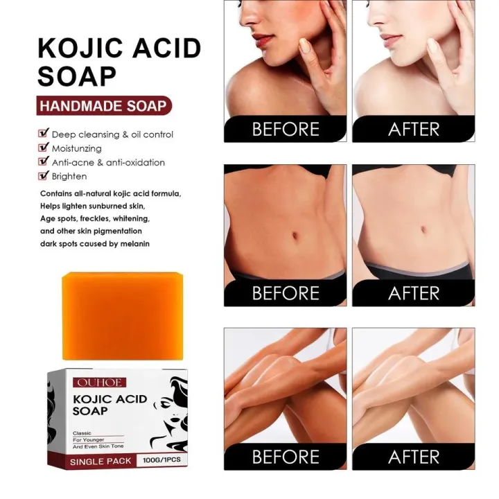 Kojic%20Acid%20Soap%20for%20Classic,%20Younger%20and%20Even%20Skin%20Tone%20100g%20-%20Image%204