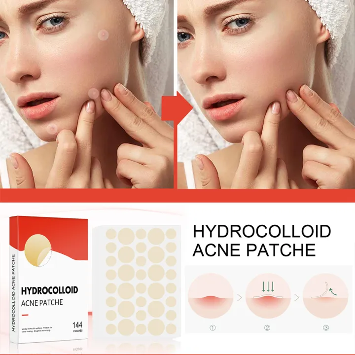 144pcs/set%20Face%20Skin%20Care%20Acne%20Pimple%20Patch%20Invisible%20Professional%20Healing%20Absorbing%20Spot%20Sticker%20Covering%20Acne%20for%20Men%20Women%20-%20Image%206