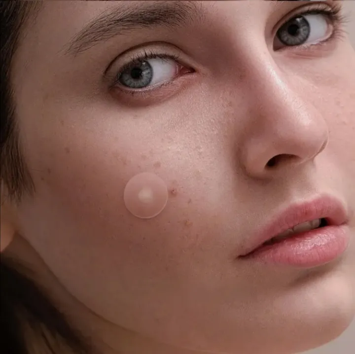 Pimple%20patch%20120pcs%20pimple%20patch%20high%20quality%20effective%20Acne%20patch%20cover%20-%20Image%205