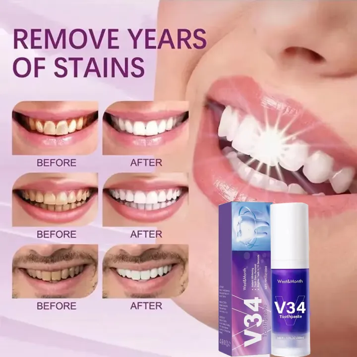 30ml%20V34%20SmileKit%20Purple%20Toothpaste%20Clean%20Oral%20Hygiene%20Fresh%20Breath%20Removes%20Tartar%20Teeth%20%20Products%20Toothpaste%20Squeezer%20-%20Image%202