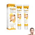 Original Vitigo Bee Venom Care Cream for Vitiligo, Pigmentation & White Spots | Skin Repair & Melanin Restoration Cream | Natural Herbal Treatment for Uneven Skin Tone | Moisturizing Anti-Spot Whitening Cream – 20g | Gadget Xpres. 