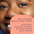 Bioré Charcoal Acne Cleanser, Salicylic Acid Treatment, Helps Prevent Breakouts, Oil Absorption and Control for Acne Prone, Oily Skin, (Canada). 