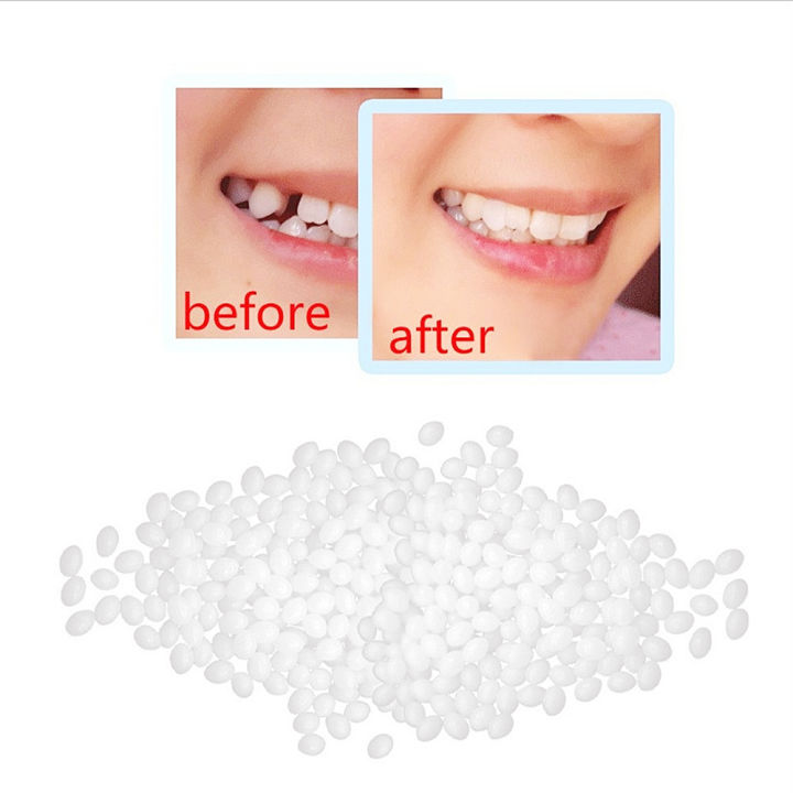 10g/Bag%20Tooth%20Repair%20Kit-Thermal%20Beads%20for%20Filling%20Fix%20The%20Missing%20and%20Broken%20Tooth%20or%20Adhesive%20The%20Denture%20Fake%20Teeth%20-%20Image%204