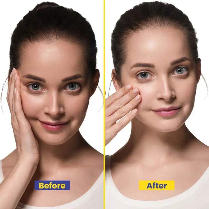 Biyocos%20Beauty%20Cream%20(Small)%20%E2%80%93%20Skin%20Brightening%20&%20Anti-Aging%20Moisturizer%20with%20Arbutin,%20Vitamin%20E,%20Kojic%20Acid,%20&%20Licorice%20Extract%20%7C%20Hydrating%20Cream%20for%20Radiant,%20Smooth%20Skin%20-%20Image%203