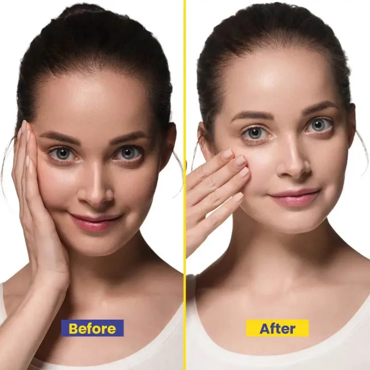 Biyocos%20Beauty%20Cream%20(Small)%20%E2%80%93%20Skin%20Brightening%20&%20Anti-Aging%20Moisturizer%20with%20Arbutin,%20Vitamin%20E,%20Kojic%20Acid,%20&%20Licorice%20Extract%20%7C%20Hydrating%20Cream%20for%20Radiant,%20Smooth%20Skin%20-%20Image%203