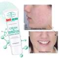 Aichun beauty Effective Acne Removal Cream Herbal Acne Spots Oil Control Acne Cream Skin Care Whitening Moisturizing Face Gel Skin Care 20gm. 