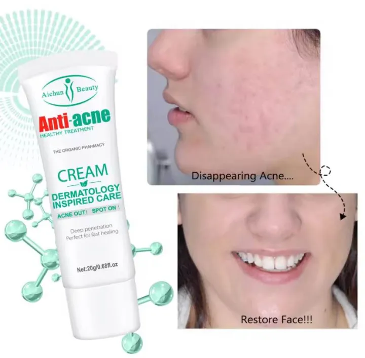 Aichun%20beauty%20Effective%20Acne%20Removal%20Cream%20Herbal%20Acne%20Spots%20Oil%20Control%20Acne%20Cream%20Skin%20Care%20Whitening%20Moisturizing%20Face%20Gel%20Skin%20Care%2020gm%20-%20Image%203