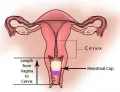 icare menstrual cup *small size *FDA approved. 