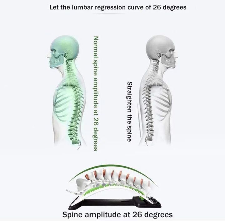 AOSRI%20Multi-Level%20Back%20Stretching%20Device,%20Curved%20Stretching%2088%20Massage%20Points%20Lying%20and%20Sitting%20Dual-Use%203-Level%20Adjustable%20Magnet%20Therapy%20Improve%20Hunchback%20Relieve%20Pain%20Black+Purple%20-%20Image%205