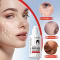 SADOER Hyaluronic Acid Moisturizing Nourishing Repair Dry Relieve Dark Skin Brightening Whitening Brighten Kojic Acid Face Serum. 
