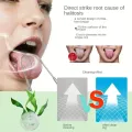 U Shape Tongue Scraper Oral Care Tools Stainless Steel Clean Mouth Clean Tongue Brush Bad Breath Tongue Tongue Cleaner. 