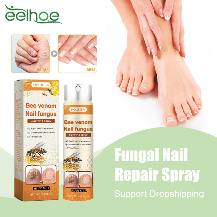 Anti Fungal Foot Spray Anti Beriberi Treatment Paronychia Onychomycosis Antibacterial Relieve Itching Feet Fungus Removal Spray freshfeet