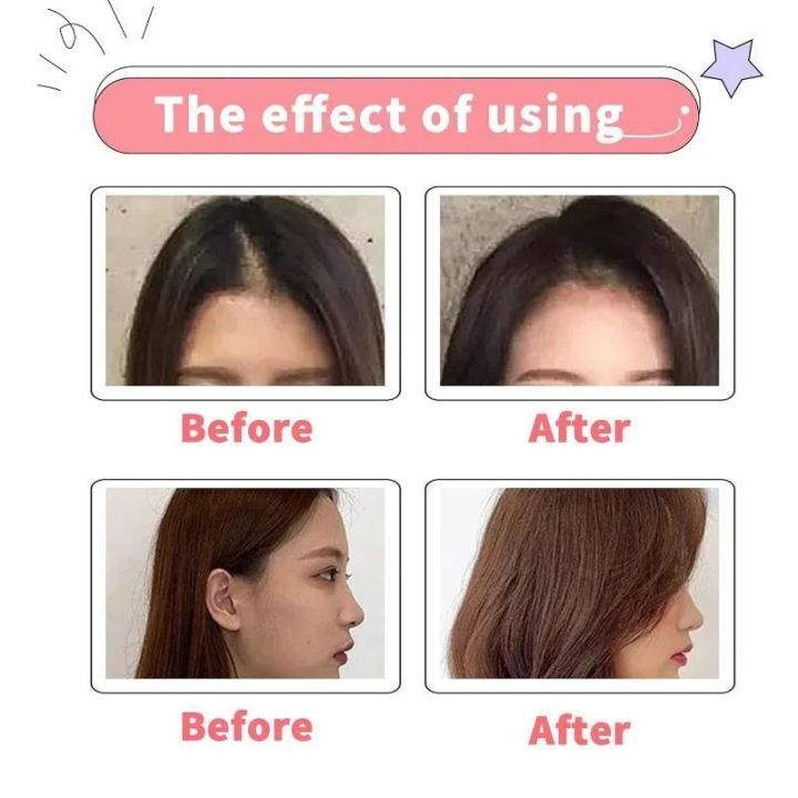Hair%20Rollers%20Volumizing%20Curlers%20Root%20Clips%20Fluffy%20Instant%20Bang%20Heatless%20Hair%20Curler%20No%20Heat%20Styling%20Tool%20-%20Image%207