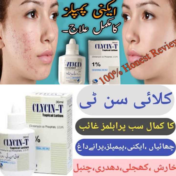 Clycin%20T%20Lotion%201%25%20-%20Image%202