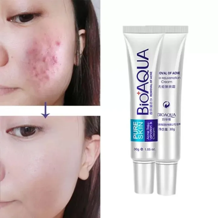 BioAqua%20Removal%20of%20Acne%20Cream%20Pimple%20Bio%20Aqu%2030g%20-%20Image%203