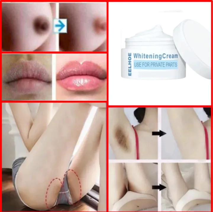 Whitening%20Cream%20for%20Sensitive%20Areas,%20Fragrance-Free,%2030ml%20-%20Smooth%20Skin%20Nourishing%20Intimate%20Care%20-%20Image%205