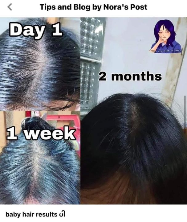%E2%9C%85Vaseline%20Hair%20Tonic%20And%20Scalp%20Conditioner%20200ml%20-%20Image%206
