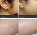 Qiansoto instant painless hair remover cream.Made in Thailand. 125 ml.