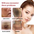 Ouhoe Dark Spot Cream 30ml. 