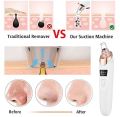 Whitehead remover | Blackhead suction machine | Pore vacuum cleaner | Deep pore cleansing device | Facial skin care tool | Acne remover | Rechargeable suction tool | Nose pore vacuum | Skin exfoliating device | Dead skin cleaner | Blackhead extractor |. 