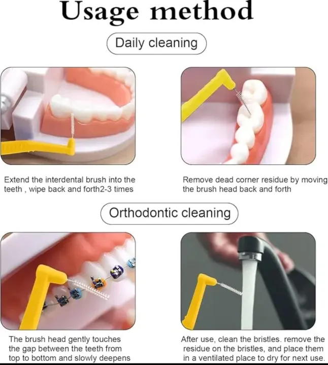 Medical%20cleaning%20interdental%20brush%20L-shaped%20interdental%20brush%20ultra-fine%20soft%20hair%20orthodontic%20special%20disposable%20bracket%20gap%20cleaning%20interdental%20brush%20-%20Image%202