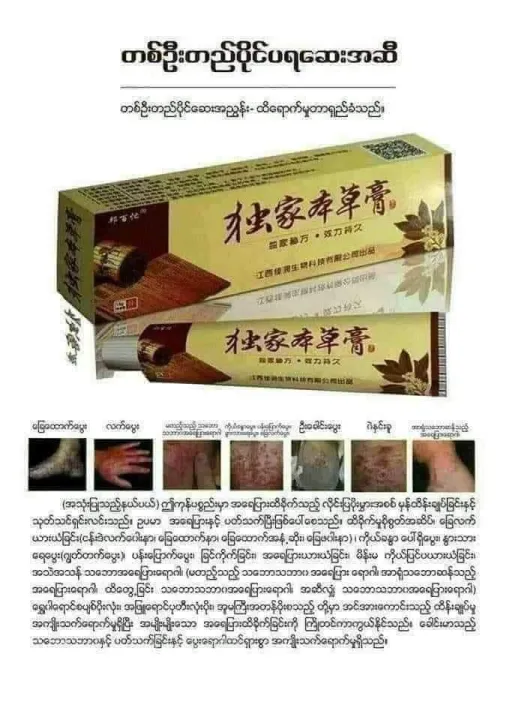 2-/%20%E1%80%95%E1%80%BD%E1%80%B1%E1%80%B8%E1%81%8A%20%E1%80%9D%E1%80%B2%E1%81%8A%E1%80%82%E1%80%BB%E1%80%BD%E1%80%90%E1%80%BA%20/%E1%80%92%E1%80%90%E1%80%BA%20%E1%80%94%E1%80%BE%E1%80%84%E1%80%BA%E1%80%B8%E1%80%81%E1%80%B0%E1%81%8A%20%E1%80%9A%E1%80%AC%E1%80%B8%E1%80%94%E1%80%AC%E1%80%95%E1%80%BC%E1%80%B1%E1%80%AC%E1%80%80%E1%80%BA%E1%80%86%E1%80%B1%E1%80%B8%0A%0A4-%E1%80%A1%E1%80%99%E1%80%AC%E1%80%9B%E1%80%BD%E1%80%90%E1%80%BA/%20%E1%80%95%E1%80%BD%E1%80%B1%E1%80%B8%E1%81%8A%20%E1%80%9D%E1%80%B2%E1%81%8A%E1%80%82%E1%80%BB%E1%80%BD%E1%80%90%E1%80%BA%20/%E1%80%92%E1%80%90%E1%80%BA%20%E1%80%94%E1%80%BE%E1%80%84%E1%80%BA%E1%80%B8%E1%80%81%E1%80%B0%E1%81%8A%20%E1%80%9A%E1%80%AC%E1%80%B8%E1%80%94%E1%80%AC%0A%E1%80%A1%E1%80%99%E1%80%BB%E1%80%AD%E1%80%AF%E1%80%B8%E1%80%99%E1%80%BB%E1%80%AD%E1%80%AF%E1%80%B8%20%E1%80%94%E1%80%BE%E1%80%84%E1%80%BA%E1%80%B7%20%E1%80%A1%E1%80%9B%E1%80%B1%E1%80%A1%E1%80%95%E1%80%BC%E1%80%AC%E1%80%B8%E1%80%A1%E1%80%90%E1%80%BD%E1%80%80%E1%80%BA%E1%80%A1%E1%80%91%E1%80%B0%E1%80%B8%E1%80%9E%E1%80%90%E1%80%84%E1%80%BA%E1%80%B8%E1%80%9C%E1%80%BD%E1%80%BE%E1%80%AC%E1%80%95%E1%80%AB%E1%80%B8%E1%80%A1%E1%80%95%E1%80%BA%E1%80%95%E1%80%AB%E1%80%9E%E1%80%8A%E1%80%BA%0A%0A%E1%80%A1%E1%80%9B%E1%80%B1%E1%80%A1%E1%80%95%E1%80%BC%E1%80%AC%E1%80%B8%E1%80%9B%E1%80%B1%E1%80%AC%E1%80%82%E1%80%AB%E1%80%A1%E1%80%99%E1%80%BB%E1%80%AD%E1%80%AF%E1%80%B8%E1%80%99%E1%80%BB%E1%80%AD%E1%80%AF%E1%80%B8%E1%80%A1%E1%80%90%E1%80%BD%E1%80%80%E1%80%BA%20%E1%80%90%E1%80%9B%E1%80%AF%E1%80%90%E1%80%BA%E1%80%9B%E1%80%AD%E1%80%AF%E1%80%B8%E1%80%9B%E1%80%AC%20%E1%80%90%E1%80%AD%E1%80%AF%E1%80%84%E1%80%BA%E1%80%B8%E1%80%9B%E1%80%84%E1%80%BA%E1%80%B8%E1%80%86%E1%80%B1%E1%80%B8%E1%80%A1%E1%80%86%E1%80%AE%20%E1%80%90%E1%80%85%E1%80%BA%E1%80%99%E1%80%BB%E1%80%AD%E1%80%AF%E1%80%B8%E1%80%80%E1%80%AD%E1%80%AF%20%E1%80%90%E1%80%9B%E1%80%AF%E1%80%90%E1%80%BA%E1%80%94%E1%80%AD%E1%80%AF%E1%80%84%E1%80%BA%E1%80%84%E1%80%B6%E1%80%99%E1%80%BE%E1%80%90%E1%80%AD%E1%80%AF%E1%80%80%E1%80%BA%E1%80%9B%E1%80%AD%E1%80%AF%E1%80%80%E1%80%BA%E1%80%90%E1%80%84%E1%80%BA%E1%80%9E%E1%80%BD%E1%80%84%E1%80%BA%E1%80%B8%20-%20Image%204